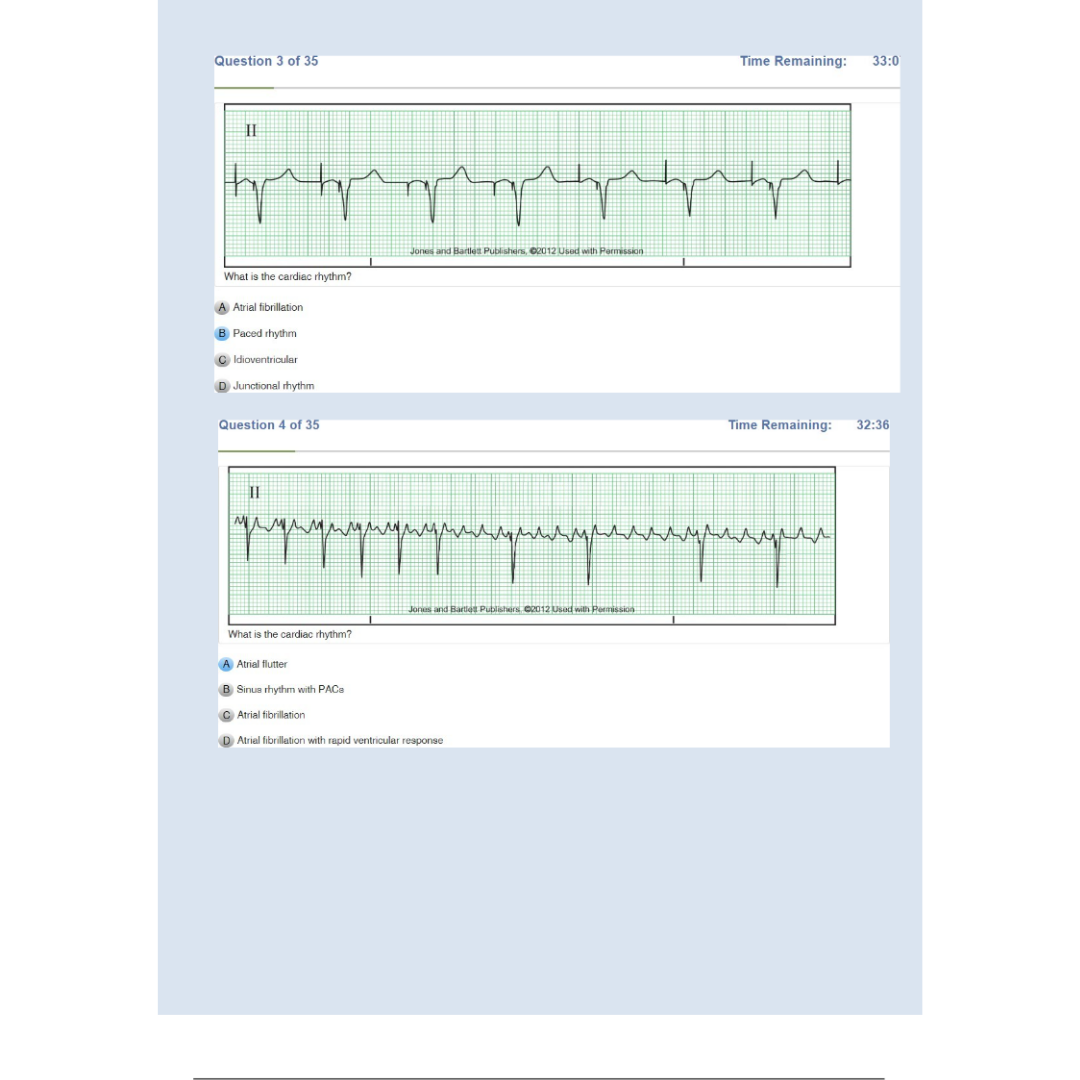 Relias Dysrhythmia Basic Test 35 Questions and Answers 2024 (Basic A Dysrhythmia)