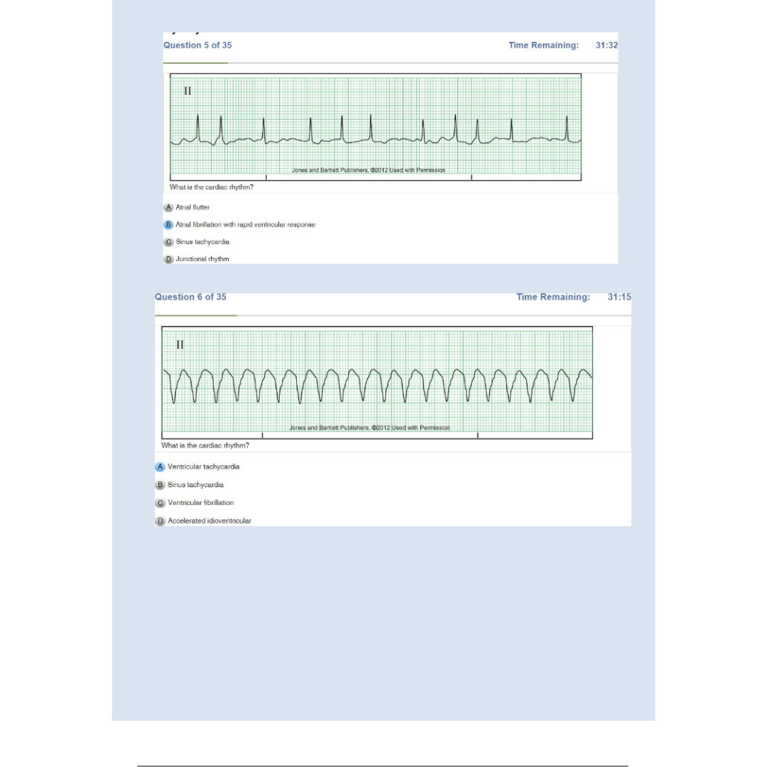 Relias Dysrhythmia Basic Test 35 Questions and Answers 2024 (Basic A Dysrhythmia)